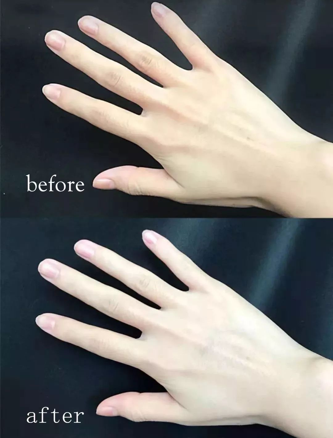 手纹深粗糙是不是比较好,手纹深粗糙干燥怎么办