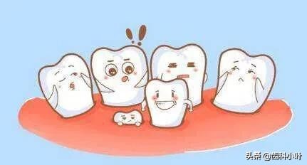 儿童牙常见问题,牙齿常见儿童牙病