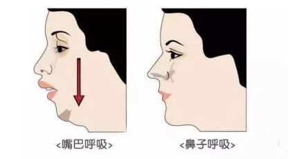 一文带你了解～气质杀手！比矮还要可怕的是脖子短粗