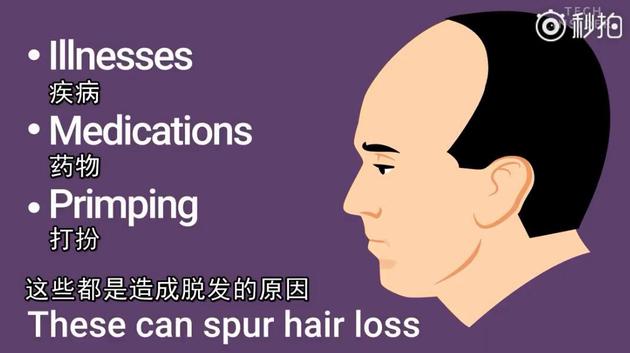 小贝上央视新闻,小贝秃头照