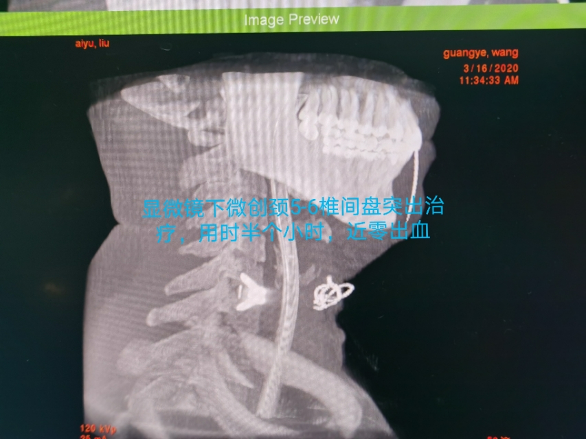 疫情期间颈椎病发作怎么办,疫情间躺久了头昏眼胀怎么治