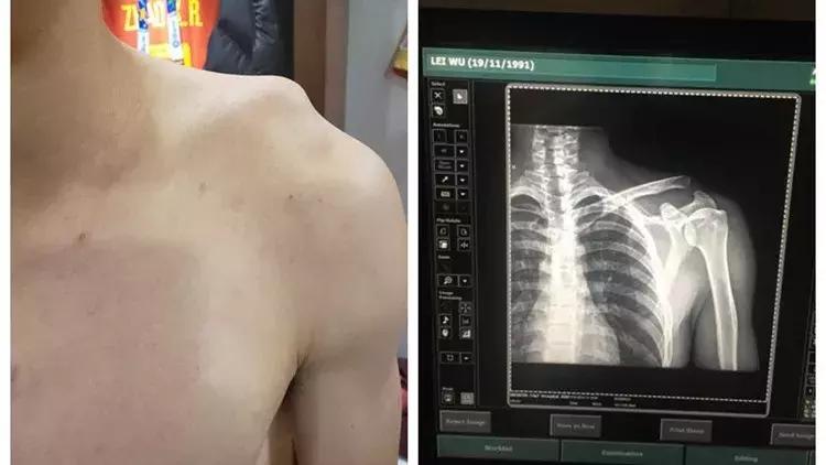 一旦开启潘多拉的魔盒就关不上了,打开了就关不上的玩具