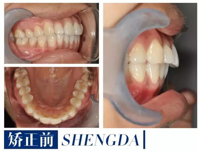 山西“爱马仕”级别齿科医院！get明星同款笑容