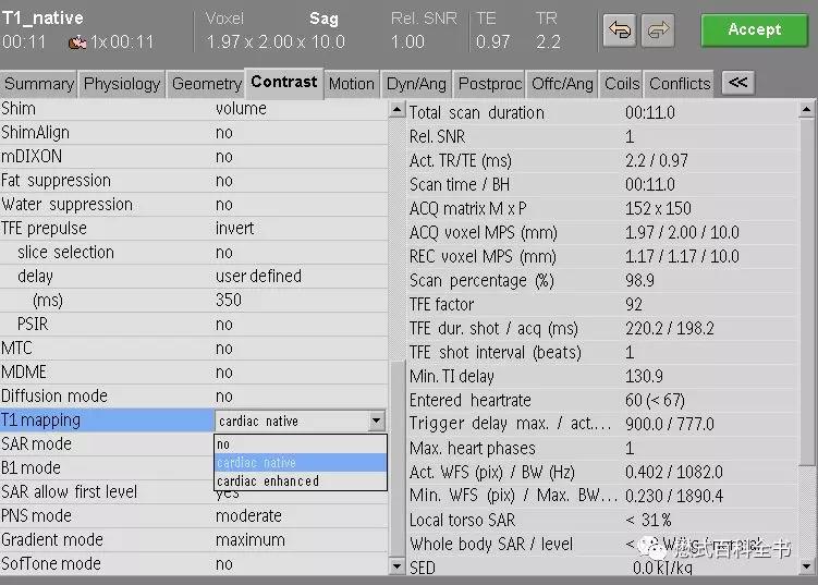 心脏磁共振定位方法,心脏磁共振各参数分析