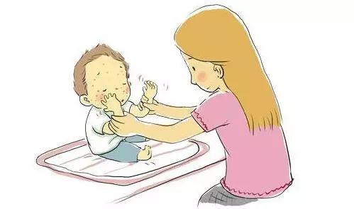 迎接二胎系列五｜婴儿湿疹