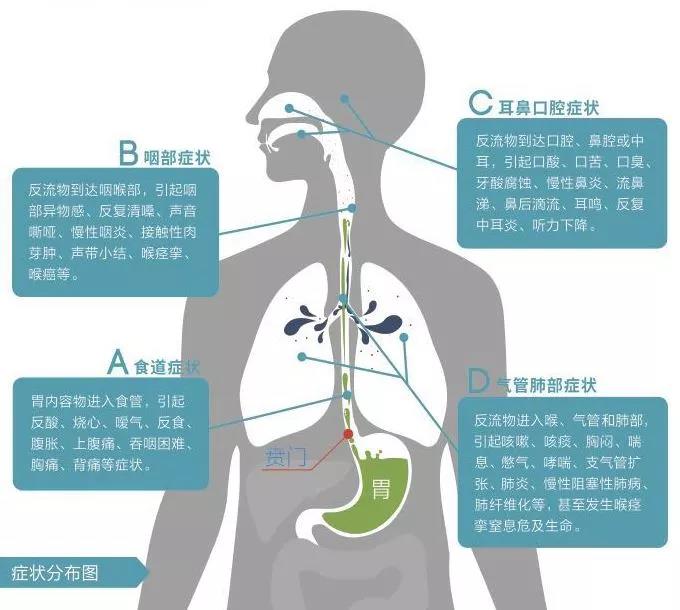 嗓子痒痒老想咳嗽应该挂哪个科室,嗓子难受咳嗽停不下来怎么回事