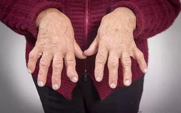 有什么中药能治子宫多发性肌瘤,什么中草药对子宫肌瘤有作用