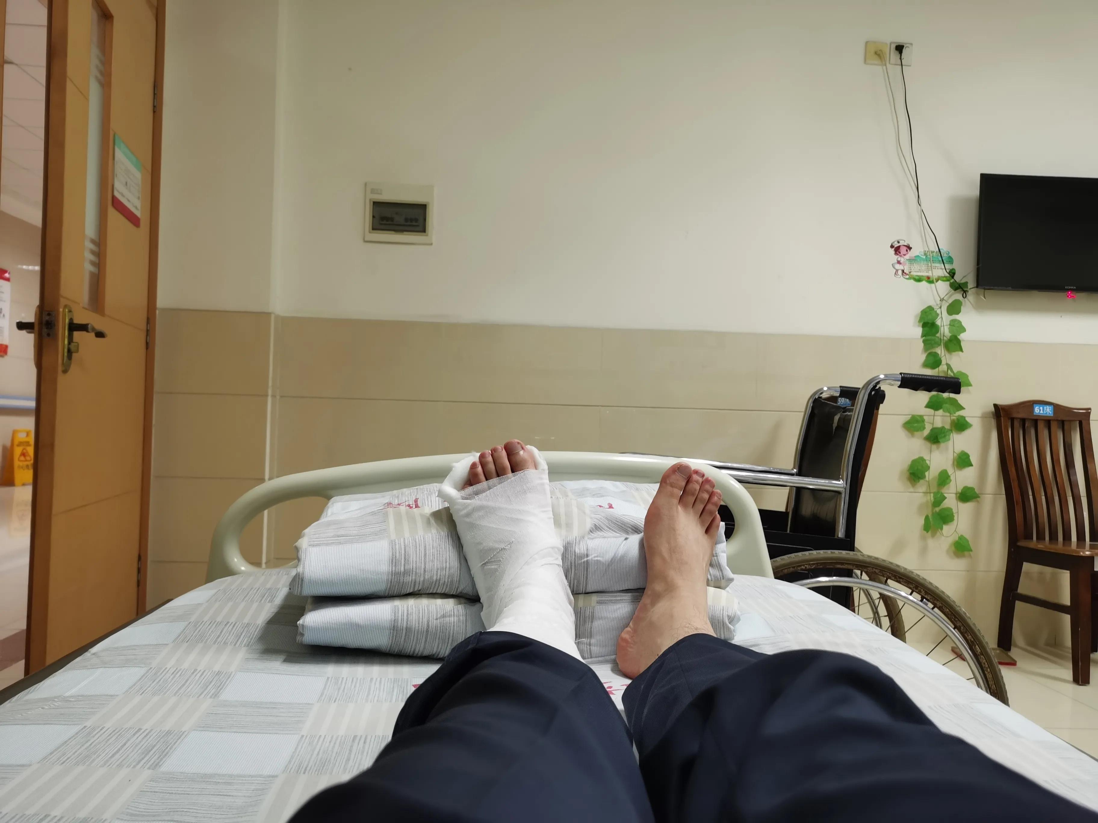 第五跖骨粉碎性骨折多久后能走路,第五跖骨基底骨折100天了走路肿