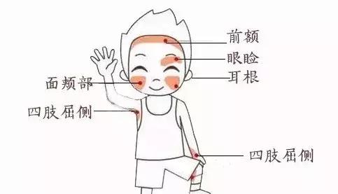 外阴湿疹用祛湿止痒软膏,专治儿童湿疹止痒特效药