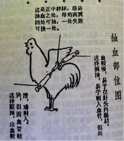 鸡血疗法治什么病最好,鸡血疗法狂热年代的神奇秘方