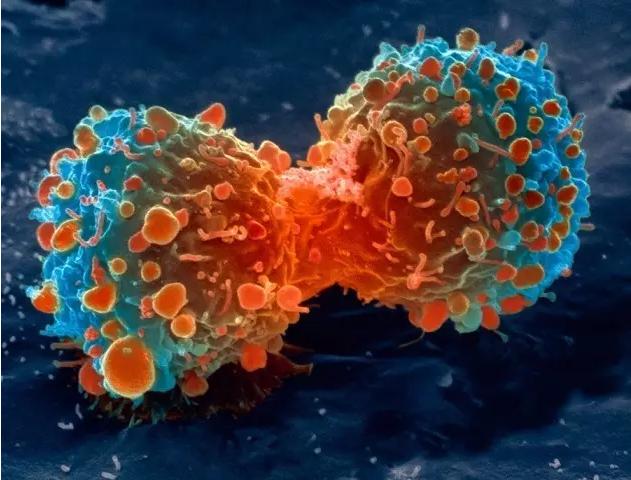 癌症怎么转移的,癌症是如何转移的