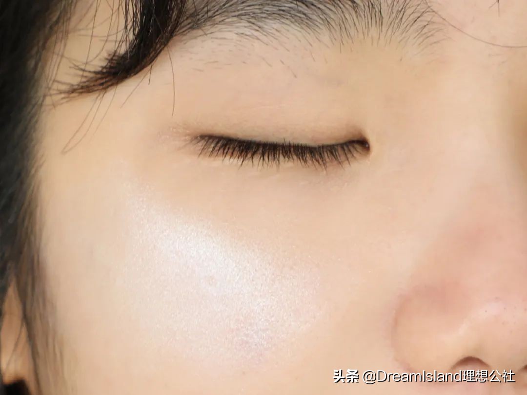 玻尿酸高光排名,打玻尿酸高光推荐