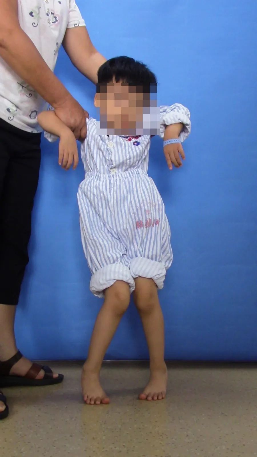 手术康复一体化,脑瘫康复训练10个方法图片