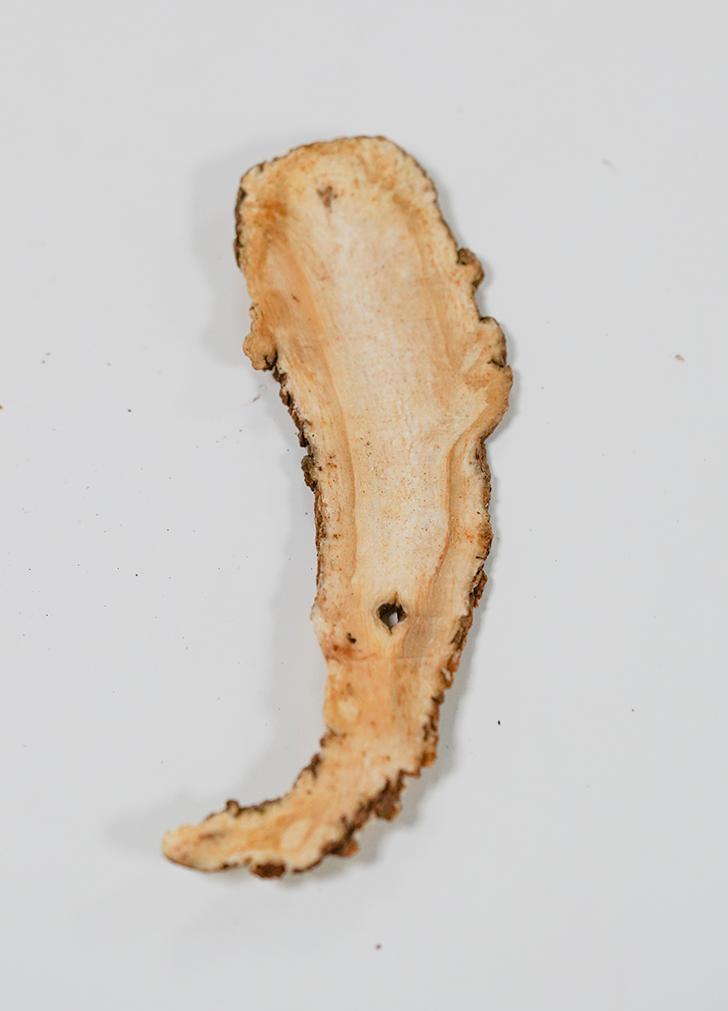 子宫肌瘤贫血中医辨证,肌瘤导致女性贫血补血最佳方法