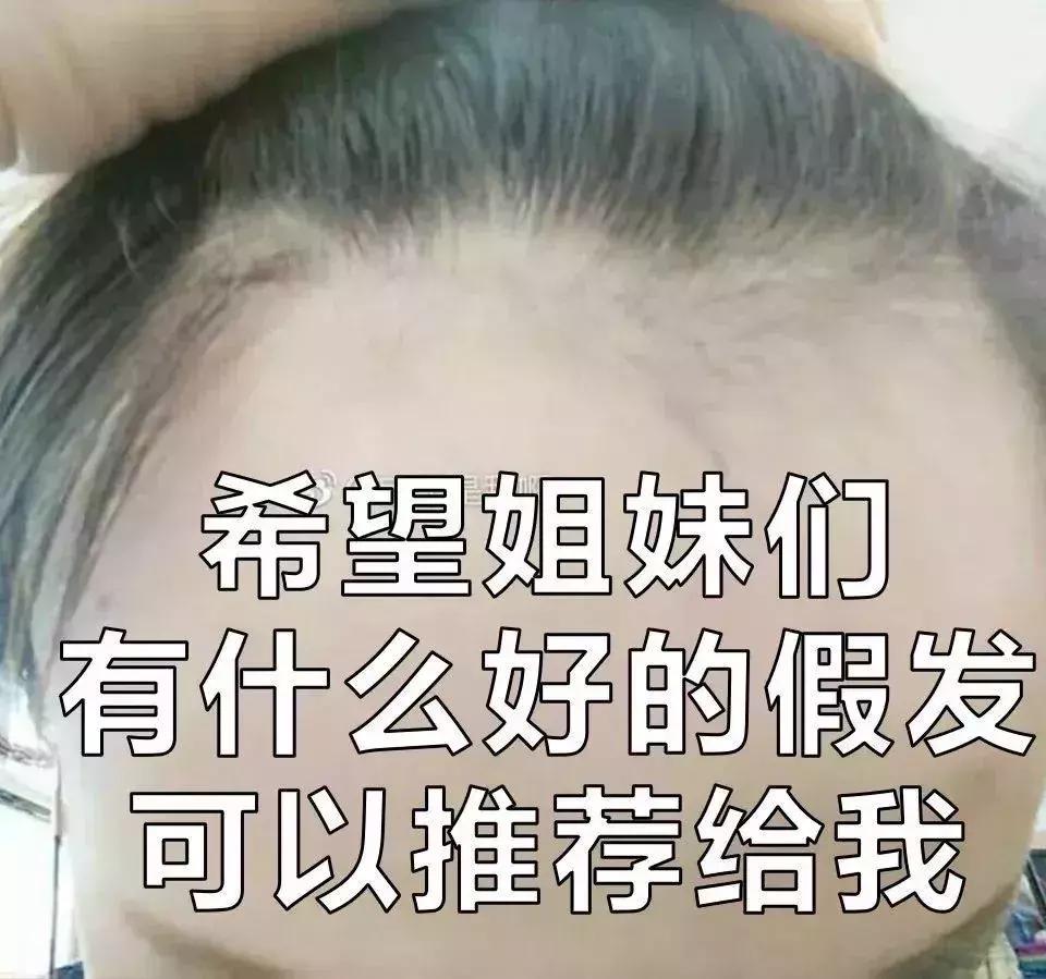 女人脱发,女性其实比男性秃