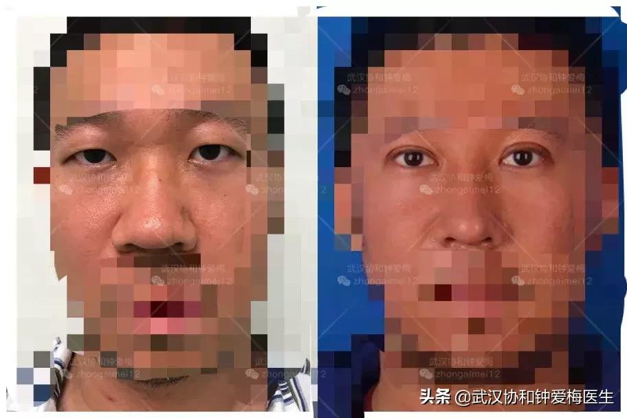 什么样的鼻子好看图片,男生什么样的鼻子最好看