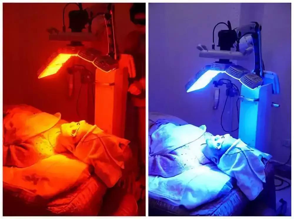 大油皮为啥还起皮,油皮是什么原因导致的怎么解决