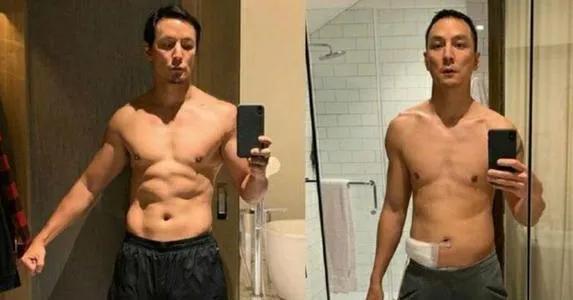 香港赌王何鸿燊治病花了多少钱,赌王何鸿燊治疗费