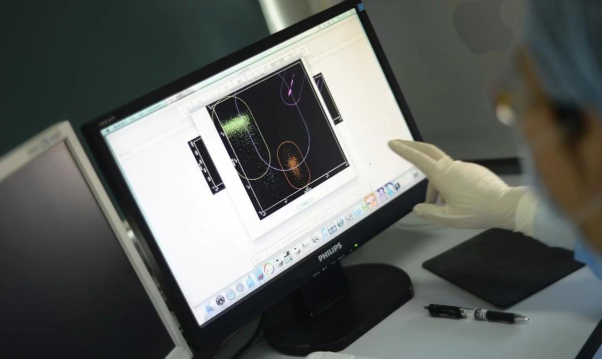 干细胞移植肝硬化研究进展,肝硬化晚期干细胞移植能维持多久