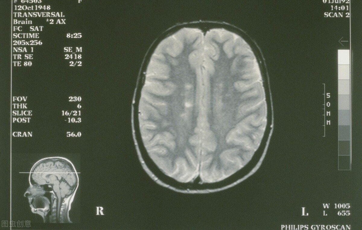 大脑的病症好治吗,大脑疾病怎么治好得快一些