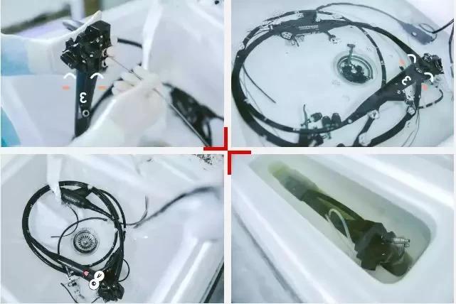 担心做胃肠镜会被感染？来看看内镜是怎么消毒的