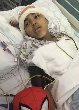 8岁男孩发作过两次癫痫,孩子癫痫一天犯50多次