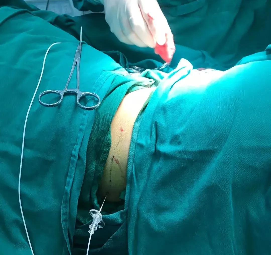 他们痛得想要自杀：被忽视的癌痛|癌痛不用药也能控制！