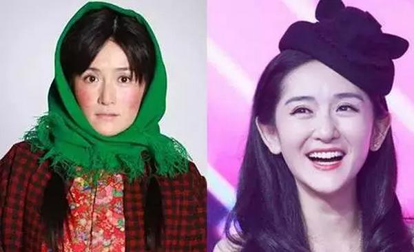 红血丝对颜值影响多大,天生红血丝泛红怎么修复