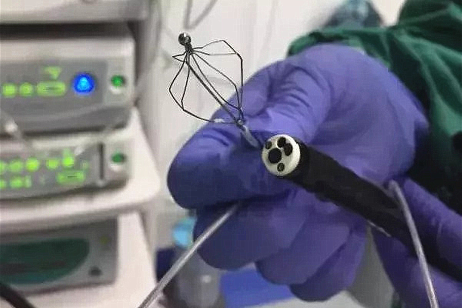 孩子误食了502强力胶,孩子误食了502强力胶吃什么药排毒