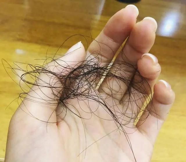 头发发质很蓬松而且很毛躁 (头发稀少不蓬松出油还厉害)