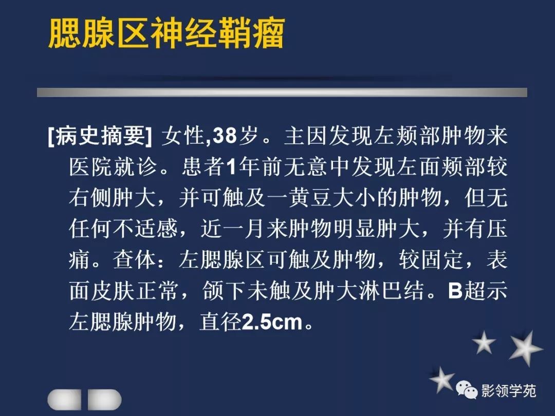 腮腺疾病影像学诊断,腮腺肿块影像诊断