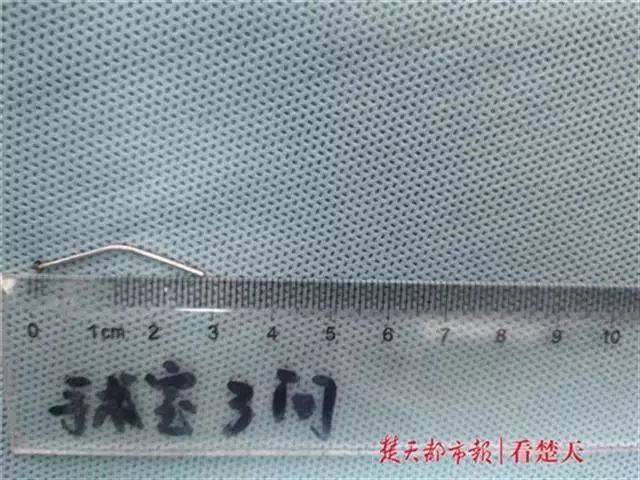 家中这些“杀手”一定要注意!2岁男孩腿上出现一凹陷的大洞