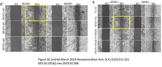 中山大学肿瘤防治中心，广州医科大学附属肿瘤医院发表论文遭质疑