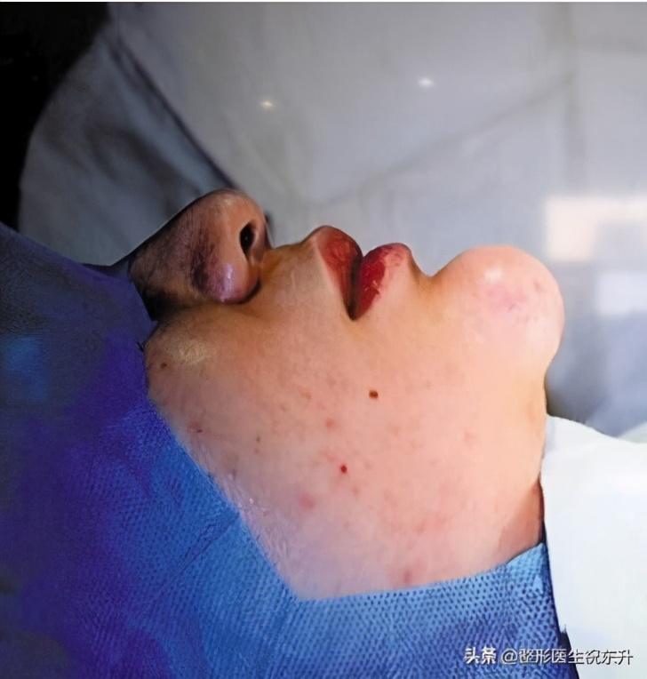 不明注射物有什么后遗症,远离不明注射物