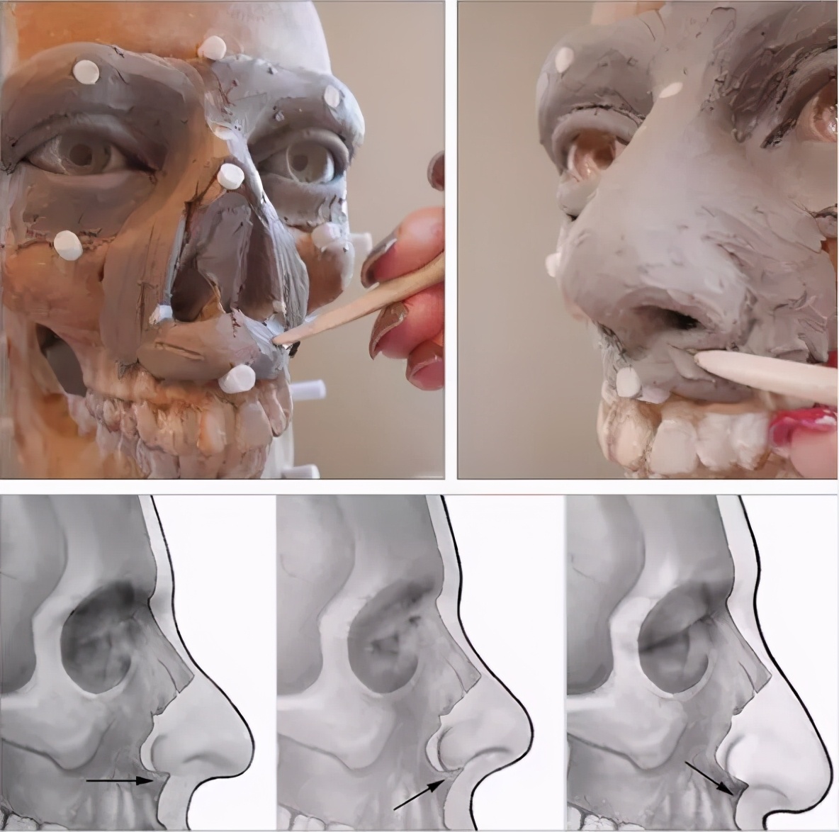 法医根据头骨还原死者,颅骨还原画像原理