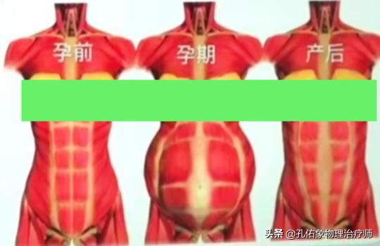 生过孩子女生体验分娩痛,生过孩子的女人老是腰痛