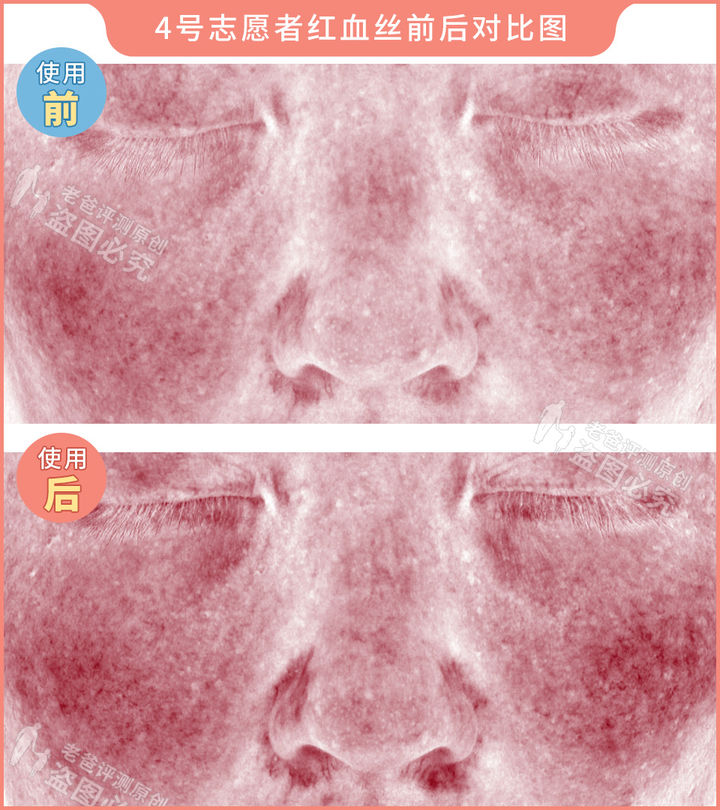 300块的网红美容仪有效果吗,网红家用美容仪测评