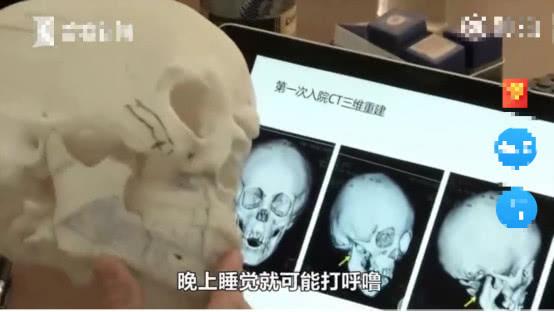 5岁男童张嘴睡觉用嘴呼吸正常吗,小孩反复张嘴闭嘴