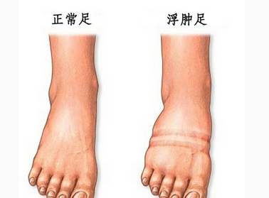 为什么女性的腿比男性的粗,女生什么样的腿型是标准的身材