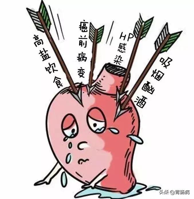 这10类人容易得胃癌，消化科医生告诉你怎么筛查