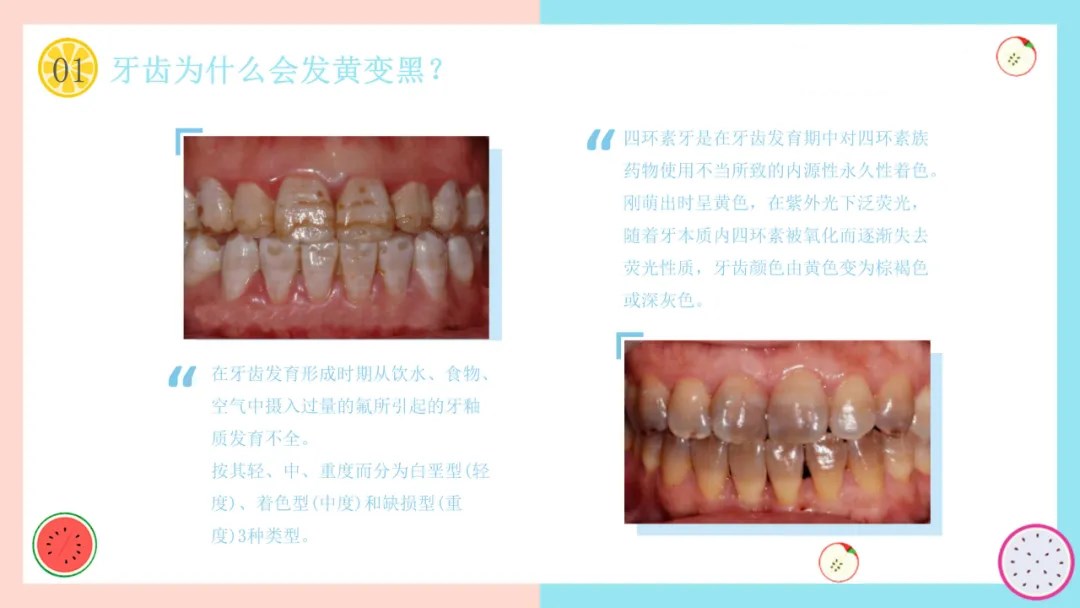 用柠檬牙齿变白的小妙招,柠檬去牙黄最有效的方法