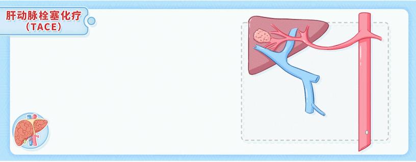 专家讲座怎么保肝护肝,专家讲护肝方法