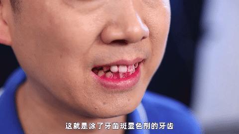 哪一款电动牙刷刷得比较干净,电动牙刷刷牙干净还是手动干净