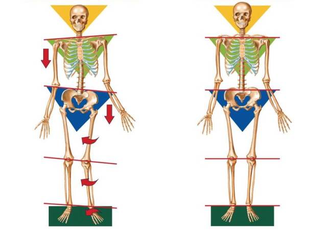 外八字脚会不会影响膝盖,跑步时八字脚产生原因及纠正方法