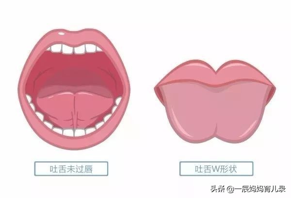 小孩子发音不标准跟舌系带有关吗,宝宝舌系带长会影响发音吗