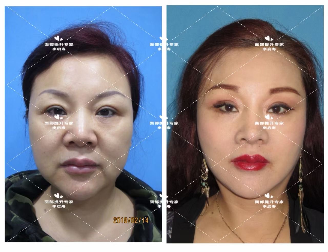 千元以下的美容仪都是智商税吗,perfmi美容仪是智商税吗