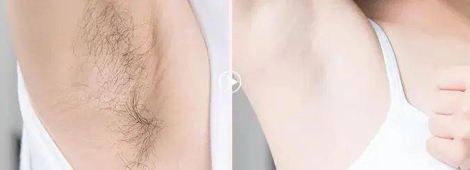 屈臣氏脱毛膏修复女士专用,屈臣氏脱毛膏新款