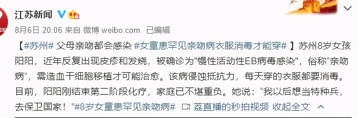 宝宝被老人亲吻后发烧,亲吻宝宝引起发烧怎么办