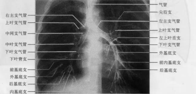 收藏：详细的胸部X线解剖，最基础最实用