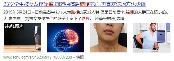 一个吻痕引起的致命性脑梗死事件，医生为你图说其中的机制